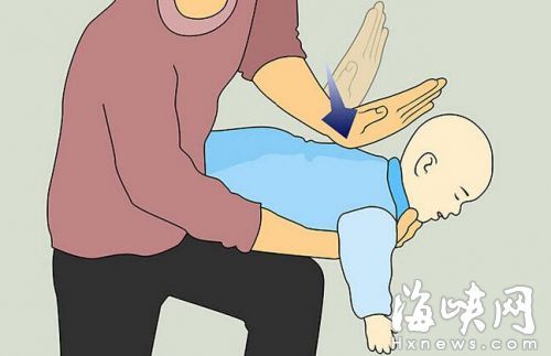 海姆立克急救法婴儿版