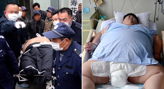 600斤"中国首胖"孙亮心脏衰竭死亡